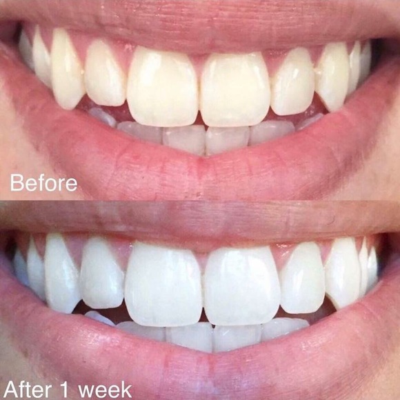 AP24 Whitening Toothpaste - Picture 3 of 3